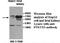 6-Phosphofructo-2-Kinase/Fructose-2,6-Biphosphatase 3 antibody, MBS416646, MyBioSource, Western Blot image 