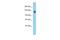 Pleckstrin Homology And RhoGEF Domain Containing G3 antibody, A13298, Boster Biological Technology, Western Blot image 