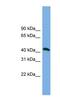 Ankyrin repeat and MYND domain-containing protein 2 antibody, NBP1-56599, Novus Biologicals, Western Blot image 