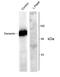 Dynamin 1 antibody, AHP907, Bio-Rad (formerly AbD Serotec) , Western Blot image 