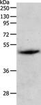 Pepsin A antibody, PA5-50549, Invitrogen Antibodies, Western Blot image 