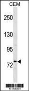 Methylenetetrahydrofolate Reductase antibody, 60-733, ProSci, Western Blot image 