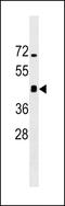 Immunity Related GTPase M antibody, LS-C164430, Lifespan Biosciences, Western Blot image 