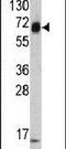 Keratin 4 antibody, PA5-13684, Invitrogen Antibodies, Western Blot image 