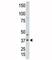 Caudal Type Homeobox 2 antibody, F49447-0.4ML, NSJ Bioreagents, Western Blot image 