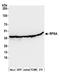 67 kDa laminin receptor antibody, A305-299A, Bethyl Labs, Western Blot image 