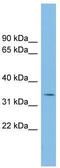 Polycomb Group Ring Finger 6 antibody, TA330481, Origene, Western Blot image 