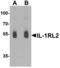 Interleukin 1 Receptor Like 2 antibody, orb314204, Biorbyt, Western Blot image 