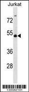 WT1 Associated Protein antibody, 58-781, ProSci, Western Blot image 