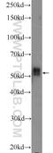 Interleukin 1 Receptor Associated Kinase 4 antibody, 18221-1-AP, Proteintech Group, Western Blot image 