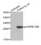 Heat Shock Protein Family B (Small) Member 1 antibody, abx000289, Abbexa, Western Blot image 