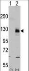 Transient Receptor Potential Cation Channel Subfamily M Member 8 antibody, LS-C100968, Lifespan Biosciences, Western Blot image 