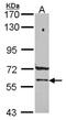 Propionyl-CoA Carboxylase Subunit Beta antibody, NBP2-19718, Novus Biologicals, Western Blot image 