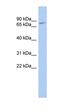 Zinc Finger And BTB Domain Containing 20 antibody, orb324421, Biorbyt, Western Blot image 