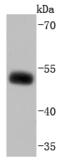 SLC9A3 Regulator 1 antibody, A02427, Boster Biological Technology, Western Blot image 