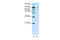Zinc Finger Protein 398 antibody, 29-167, ProSci, Western Blot image 