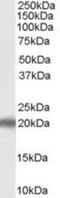 P53 Apoptosis Effector Related To PMP22 antibody, NB100-2912, Novus Biologicals, Western Blot image 