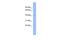 TRNA Methyltransferase 10C, Mitochondrial RNase P Subunit antibody, PA5-41873, Invitrogen Antibodies, Western Blot image 