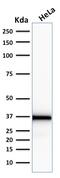 Emerin antibody, GTX18054, GeneTex, Western Blot image 