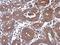 Protein Phosphatase, Mg2+/Mn2+ Dependent 1J antibody, GTX103370, GeneTex, Immunohistochemistry paraffin image 