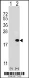 Ubiquitin Conjugating Enzyme E2 V1 antibody, 61-118, ProSci, Western Blot image 