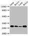 Stratifin antibody, CSB-PA021135LA01HU, Cusabio, Western Blot image 