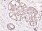 Histone Deacetylase 5 antibody, PA5-36647, Invitrogen Antibodies, Immunohistochemistry frozen image 