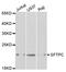 Surfactant Protein C antibody, orb136300, Biorbyt, Western Blot image 
