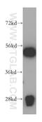 Tryptophanyl-TRNA Synthetase antibody, 16081-1-AP, Proteintech Group, Western Blot image 