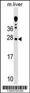 T-cell receptor-interacting molecule antibody, 58-981, ProSci, Western Blot image 