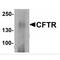 CF Transmembrane Conductance Regulator antibody, MBS153561, MyBioSource, Western Blot image 