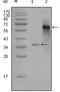 Nuclear Receptor Coactivator 3 antibody, M01337, Boster Biological Technology, Western Blot image 