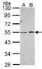 Phosphatidylinositol-5-Phosphate 4-Kinase Type 2 Alpha antibody, NBP2-19835, Novus Biologicals, Western Blot image 