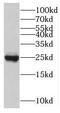 Troponin I1, Slow Skeletal Type antibody, FNab08838, FineTest, Western Blot image 