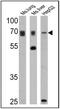 ATP-binding cassette sub-family D member 3 antibody, PA1-650, Invitrogen Antibodies, Western Blot image 