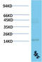 Transthyretin antibody, STJ98887, St John