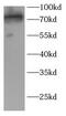 TGF-Beta Activated Kinase 1 (MAP3K7) Binding Protein 2 antibody, FNab10157, FineTest, Western Blot image 