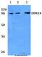 DEAD-Box Helicase 24 antibody, GTX00825, GeneTex, Western Blot image 