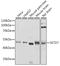 SET Domain Containing 7, Histone Lysine Methyltransferase antibody, A9985, ABclonal Technology, Western Blot image 