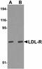 Low Density Lipoprotein Receptor antibody, LS-C108515, Lifespan Biosciences, Western Blot image 