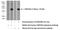 PH Domain Containing Endocytic Trafficking Adaptor 1 antibody, 21504-1-AP, Proteintech Group, Western Blot image 