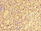 SNAI2 antibody, orb46123, Biorbyt, Immunohistochemistry paraffin image 