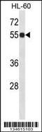 Inosine Monophosphate Dehydrogenase 1 antibody, 57-919, ProSci, Western Blot image 