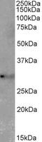 Tetraspanin 14 antibody, EB11779, Everest Biotech, Western Blot image 