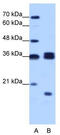 Heterogeneous Nuclear Ribonucleoprotein H3 antibody, TA343782, Origene, Western Blot image 