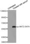 AKT Serine/Threonine Kinase 2 antibody, MBS128473, MyBioSource, Western Blot image 