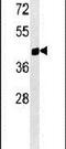 Prostaglandin Reductase 1 antibody, PA5-25834, Invitrogen Antibodies, Western Blot image 