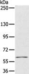 Pyruvate Dehyrogenase Phosphatase Catalytic Subunit 1 antibody, PA5-50477, Invitrogen Antibodies, Western Blot image 