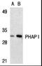 Acidic Nuclear Phosphoprotein 32 Family Member A antibody, NBP2-25097, Novus Biologicals, Western Blot image 