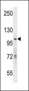 Histone acetyltransferase KAT2A antibody, 56-274, ProSci, Western Blot image 